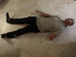 Dapper Cadaver Workshop Dura Severe Trauma Richard Body