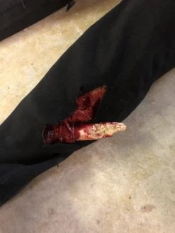 Dapper Cadaver Workshop Dura Severe Trauma Richard Body