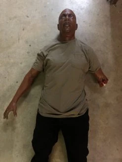 Dapper Cadaver Workshop Dura Severe Trauma Richard Body