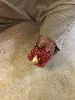 Dapper Cadaver Workshop Dura Severe Trauma Richard Body