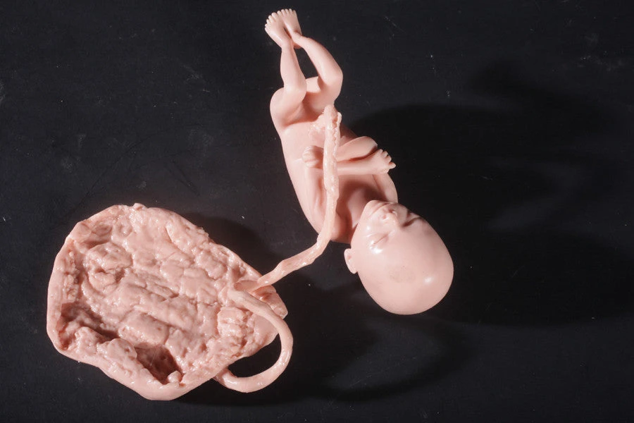 Nasco Body Props Fetus Replica At 5 Months Rental 1 Nasco Body Props Fetus Replica At 5 Months Rental