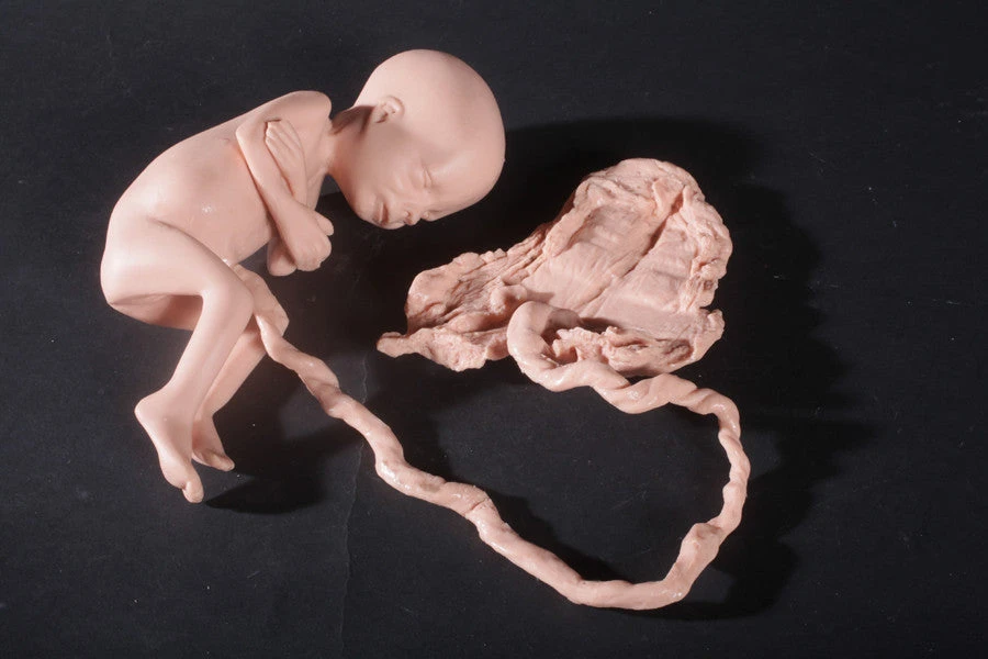 Nasco Fetus Replica At 7 Months Rental 1 Nasco Fetus Replica At 7 Months Rental