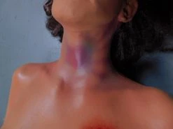 Dapper Cadaver Workshop Dura Severe Trauma Lucy Body Wounded