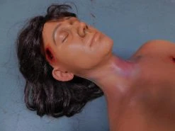 Dapper Cadaver Workshop Dura Severe Trauma Jessica Body