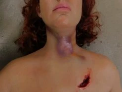 Dapper Cadaver Workshop Dura Severe Trauma Jessica Body