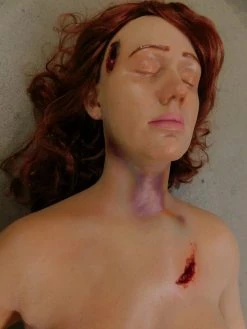 Dapper Cadaver Workshop Dura Severe Trauma Jessica Body