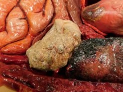 Dapper Cadaver Workshop Dura Internal Disease Autopsy Jack Body Autopsy & Medical