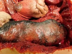 Dapper Cadaver Workshop Dura Internal Disease Autopsy Jack Body Autopsy & Medical