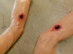 Dapper Cadaver Workshop Dura Martin Arm With Gunshot Through And Through Wounded