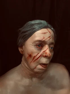 Dapper Cadaver Workshop Dura Laceration Edith Head Wounded