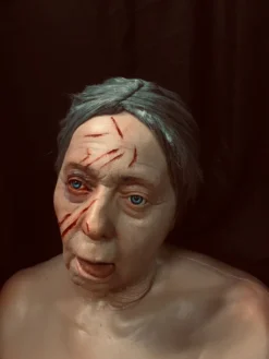 Dapper Cadaver Workshop Dura Laceration Edith Head Wounded