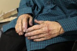 Dapper Cadaver Workshop Dura Dead Boris Figure