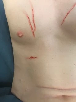 Dapper Cadaver Workshop Trauma Torso Skin Torsos And Half Bodies