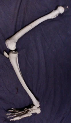 Skeletons And More Skeletons, Skulls & Bones Full Skeletal Leg