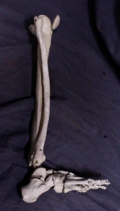 Skeletons And More Skeletons, Skulls & Bones Half Skeletal Leg