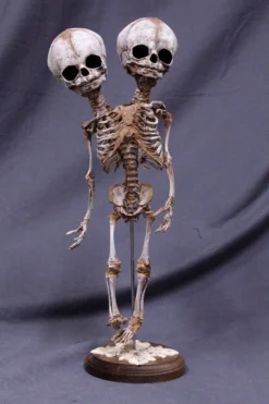 Skeletons And More Skeletons, Skulls & Bones Two Headed Fetal Skeleton