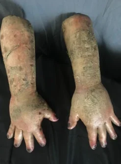 Dapper Cadaver Workshop Rotten Bloated Arms Decayed & Mummy