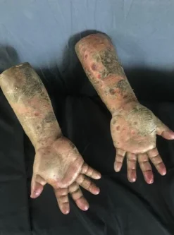 Dapper Cadaver Workshop Rotten Bloated Arms Decayed & Mummy