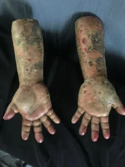 Dapper Cadaver Workshop Rotten Bloated Arms Decayed & Mummy