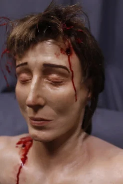 Dapper Cadaver Workshop Dura Gunshot Judith Head