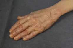 Dapper Cadaver Workshop Dura Rubber Dura Edith Arms