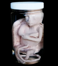 Dapper Cadaver Workshop Fetus Replica At 5 Months In Specimen Jar