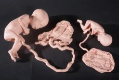 Nasco Body Props Fetus Replica At 5 Months Rental 7 Nasco Body Props Fetus Replica At 5 Months Rental