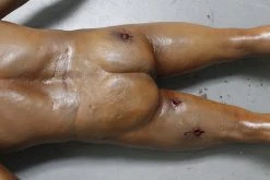 Dapper Cadaver Workshop Wounded Dura Gunshot Ben Body