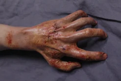 Dapper Cadaver Workshop Burn & Bomb Dura Radiation Burn Jerry Half Arms