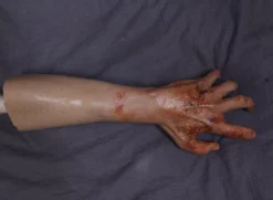 Dapper Cadaver Workshop Burn & Bomb Dura Radiation Burn Jerry Half Arms