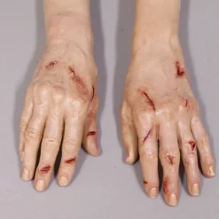 Dapper Cadaver Workshop Dura Laceration Leslie Hands Wounded