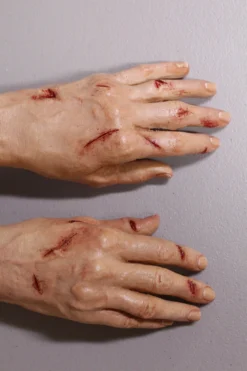 Dapper Cadaver Workshop Dura Laceration Leslie Hands Wounded