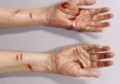 Dapper Cadaver Workshop Dura Laceration Leslie Hands Wounded