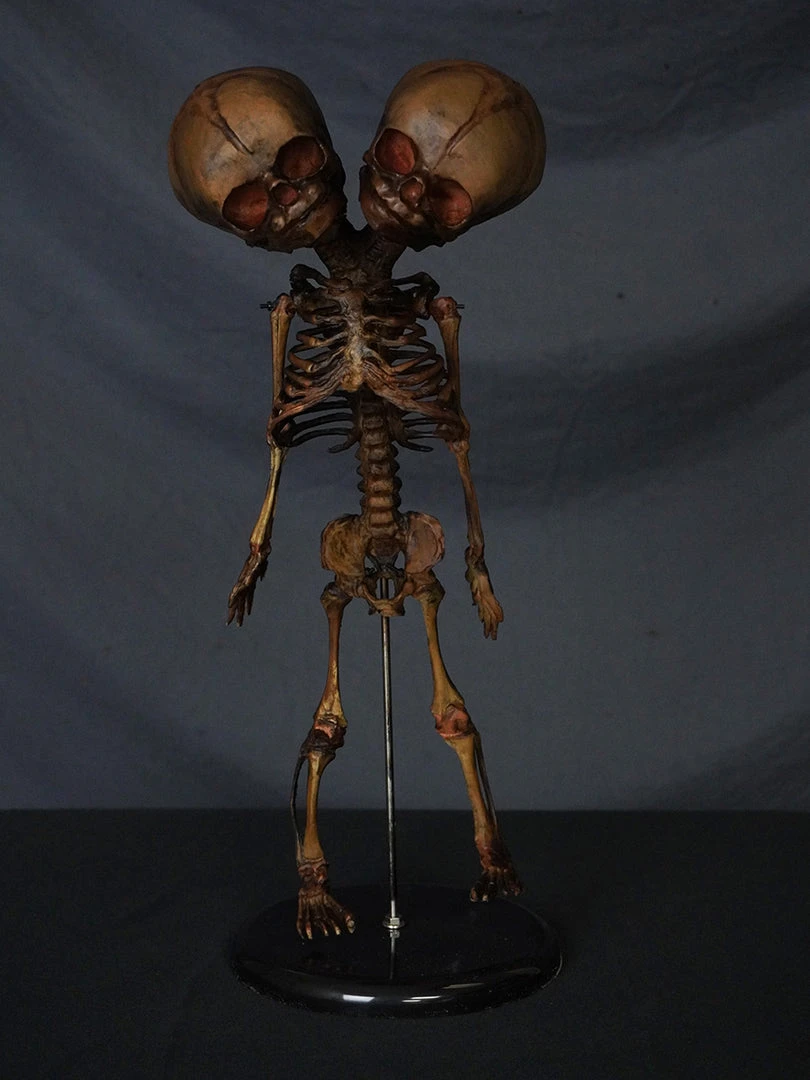 Skeletons And More Skeletons, Skulls & Bones Two Headed Fetal Skeleton 2 Skeletons And More Skeletons, Skulls & Bones Two Headed Fetal Skeleton
